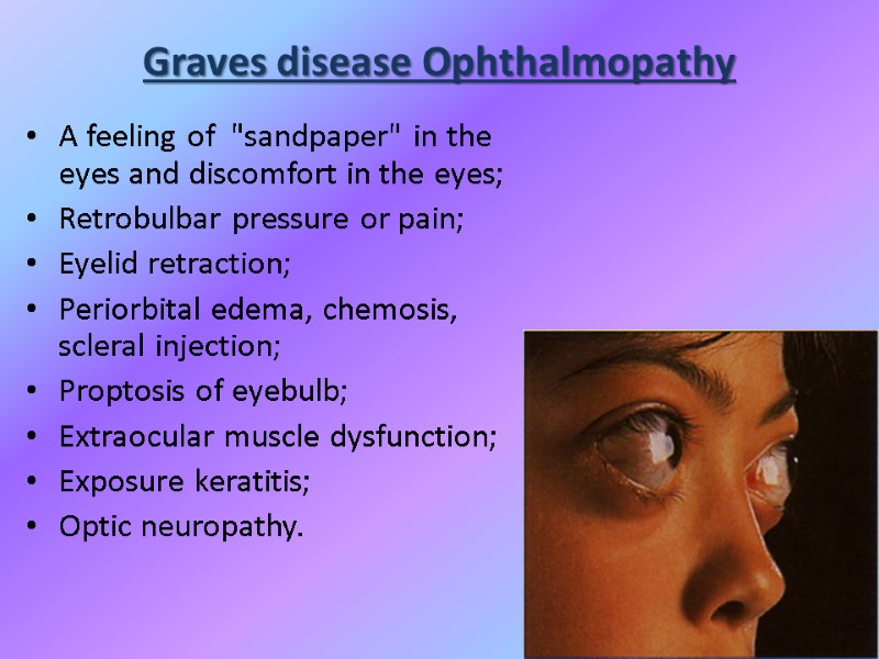 Graves disease Ophthalmopathy A feeling of  